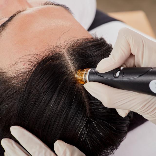 Keravive Hair Treatment