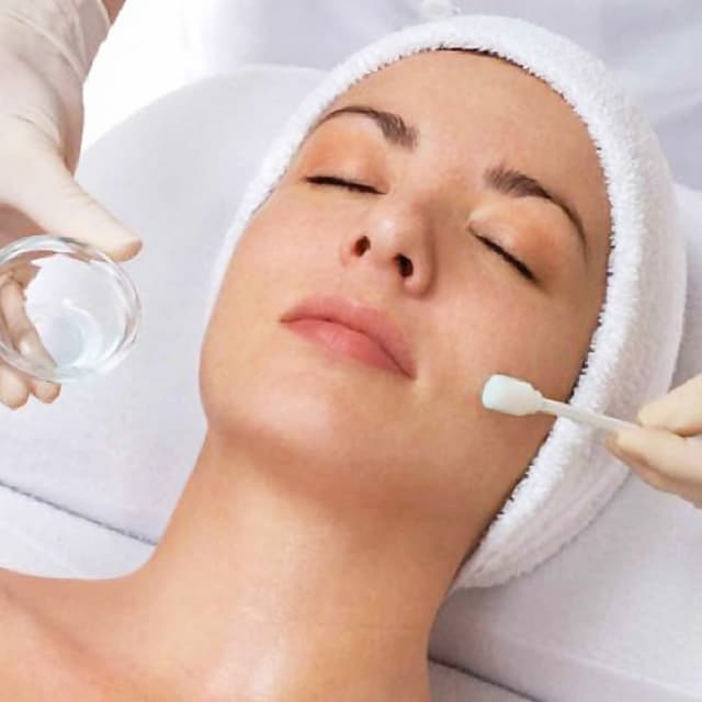 Microneedling + Chemical Peel at NUyou Regenerative Medical Spa in Bartlesville, OK